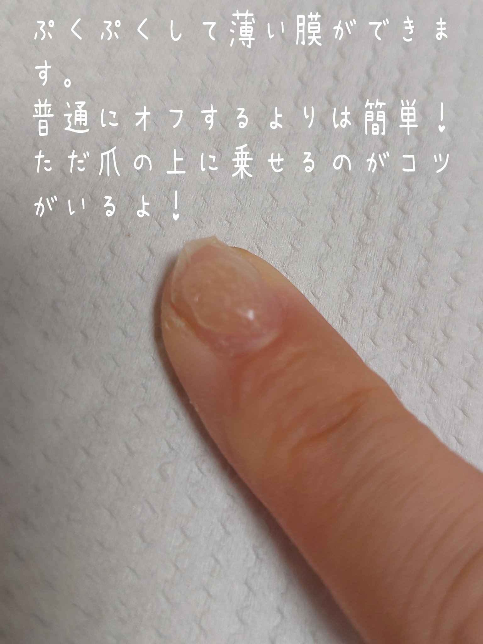 ARKEY TOKYO ウルトラトップ10のクチコミ「ネイル工房のリムル使ってみました。

最近ピールオフではなく
ノンサンディングベースジェルでジ.....」（3枚目）