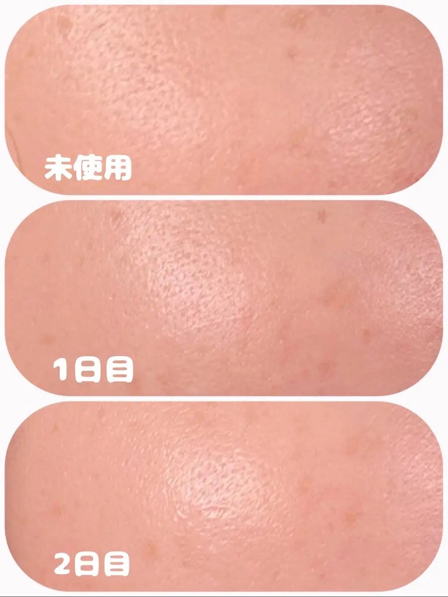 ハイドラAアンプル/Dr.lonnie/美容液を使ったクチコミ(4枚目)