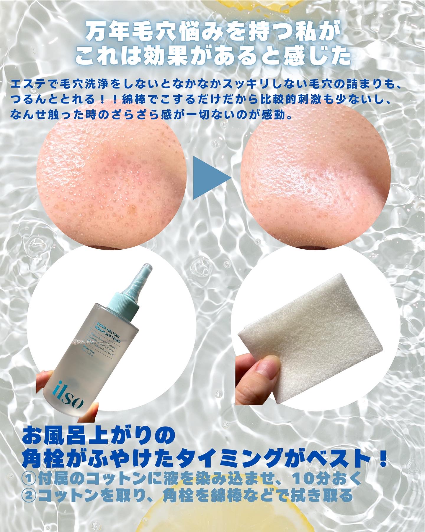 ILSO　スーパーメルティング セバムソフトナー/ilso/化粧水を使ったクチコミ（2枚目）