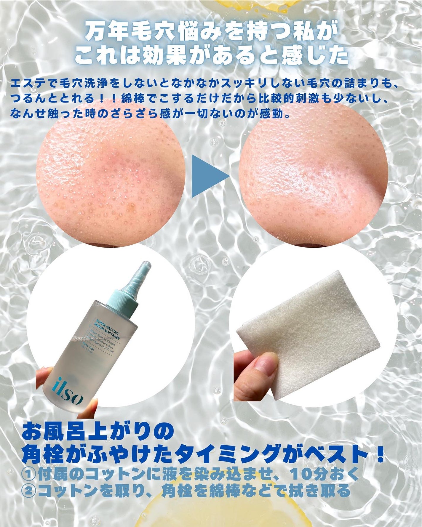 ILSO スーパーメルティング セバムソフトナー/ilso/化粧水を使ったクチコミ(2枚目)