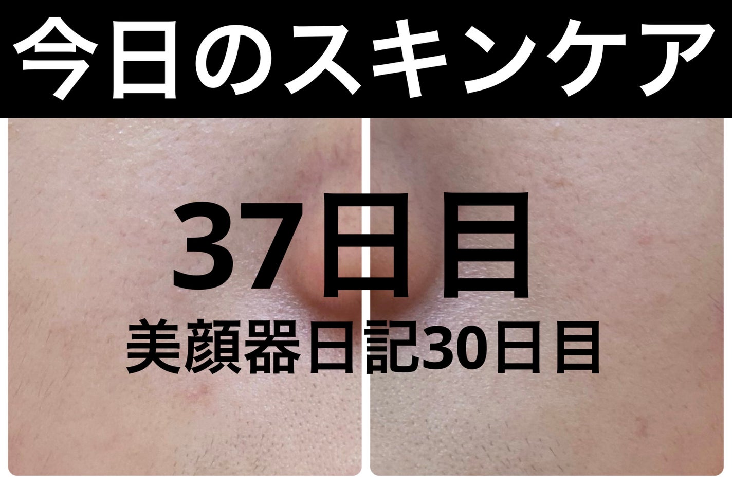 AGE-R ブースタープロ/MEDICUBE/美顔器・マッサージを使ったクチコミ(1枚目)