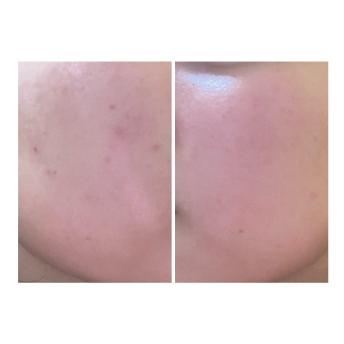 ぽむ on LIPS 「1枚目 2025.9.23エピデュオ 741日目2枚目 202..」(4枚目)