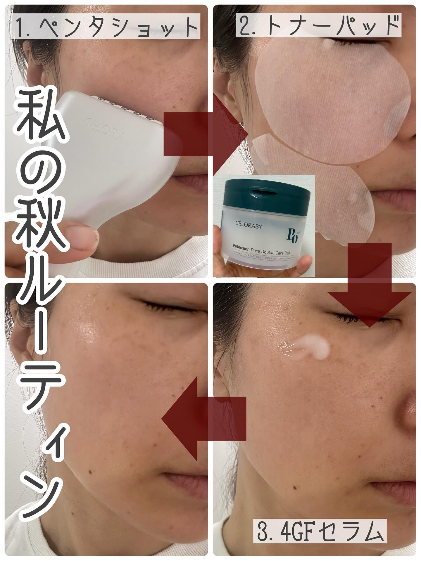 4GF ダーマリペアハイドロセラム/CELORABY/美容液を使ったクチコミ（2枚目）