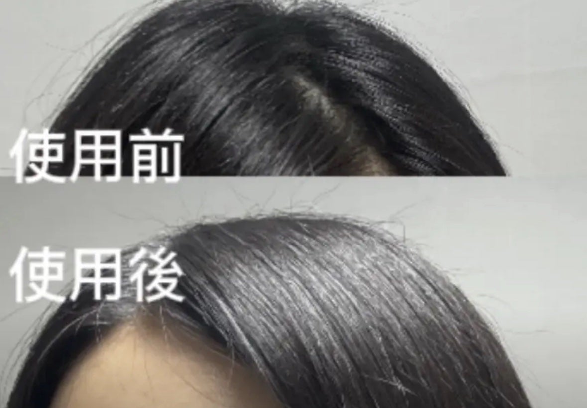 リカバリー オイルエッセンス/treecell/アウトバストリートメントを使ったクチコミ(8枚目)