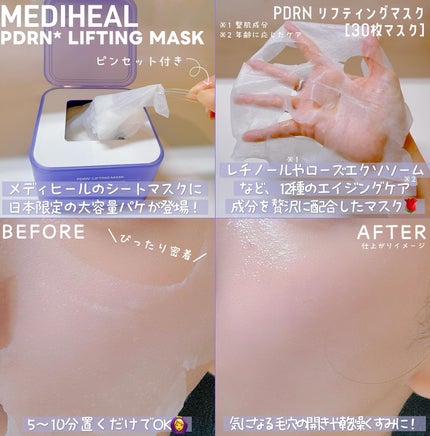 PDRN リフティングマスク/MEDIHEAL/シートマスク・パックを使ったクチコミ(2枚目)