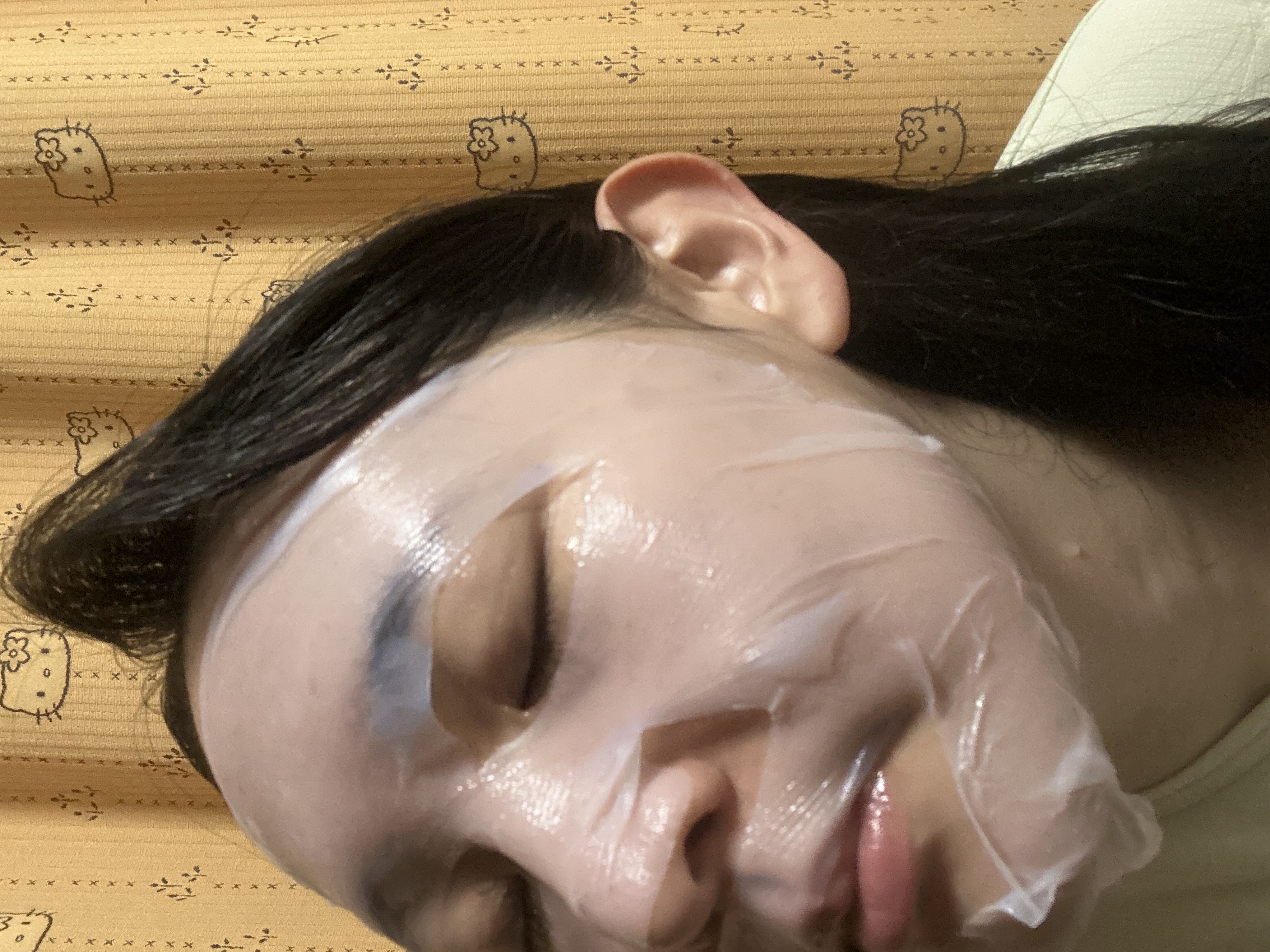 トラブルパッチマスク/EIOM/その他スキンケアを使ったクチコミ（1枚目）