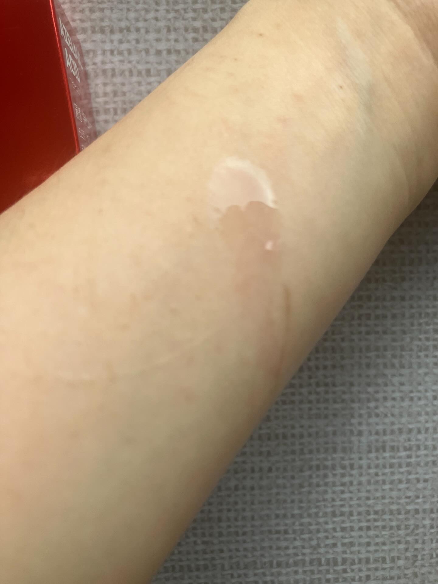 リードルS AZ ケアセラム/VT/美容液を使ったクチコミ（2枚目）