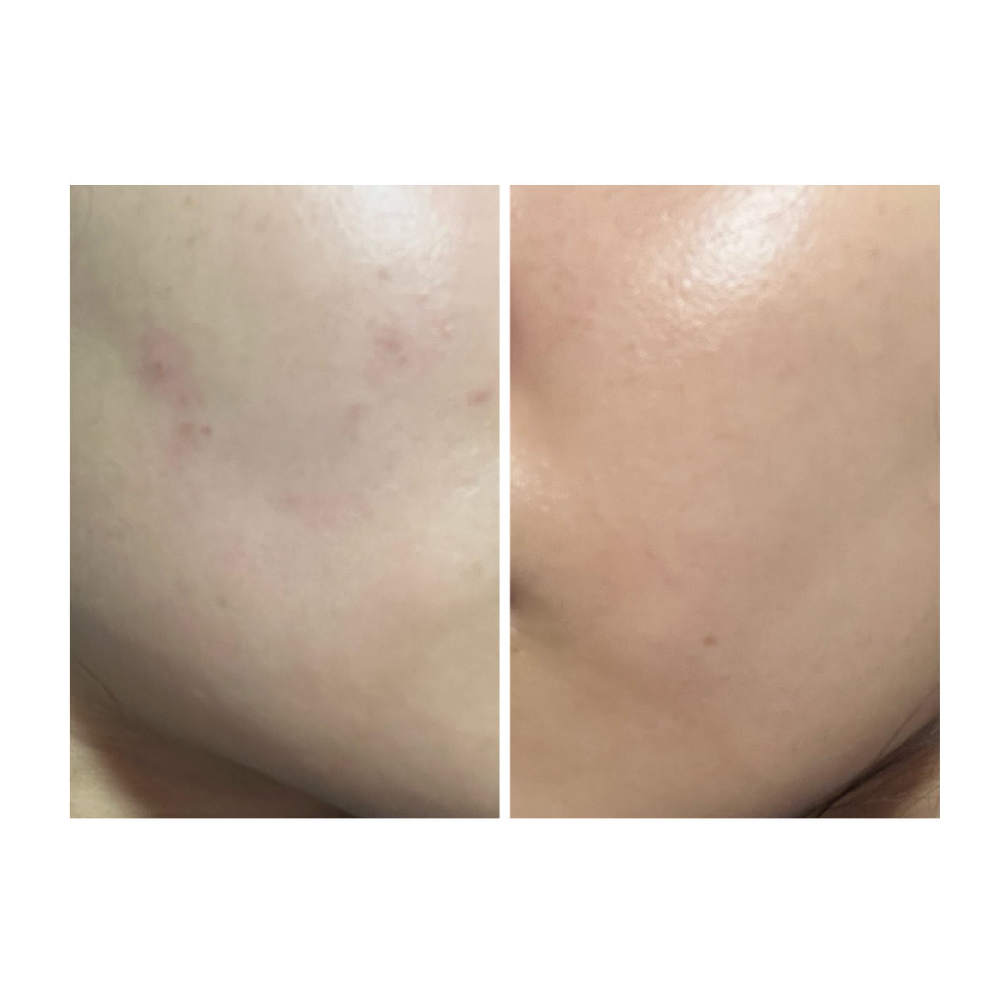 ぽむ on LIPS 「1枚目 2025.9.23エピデュオ 741日目2枚目 202..」(2枚目)