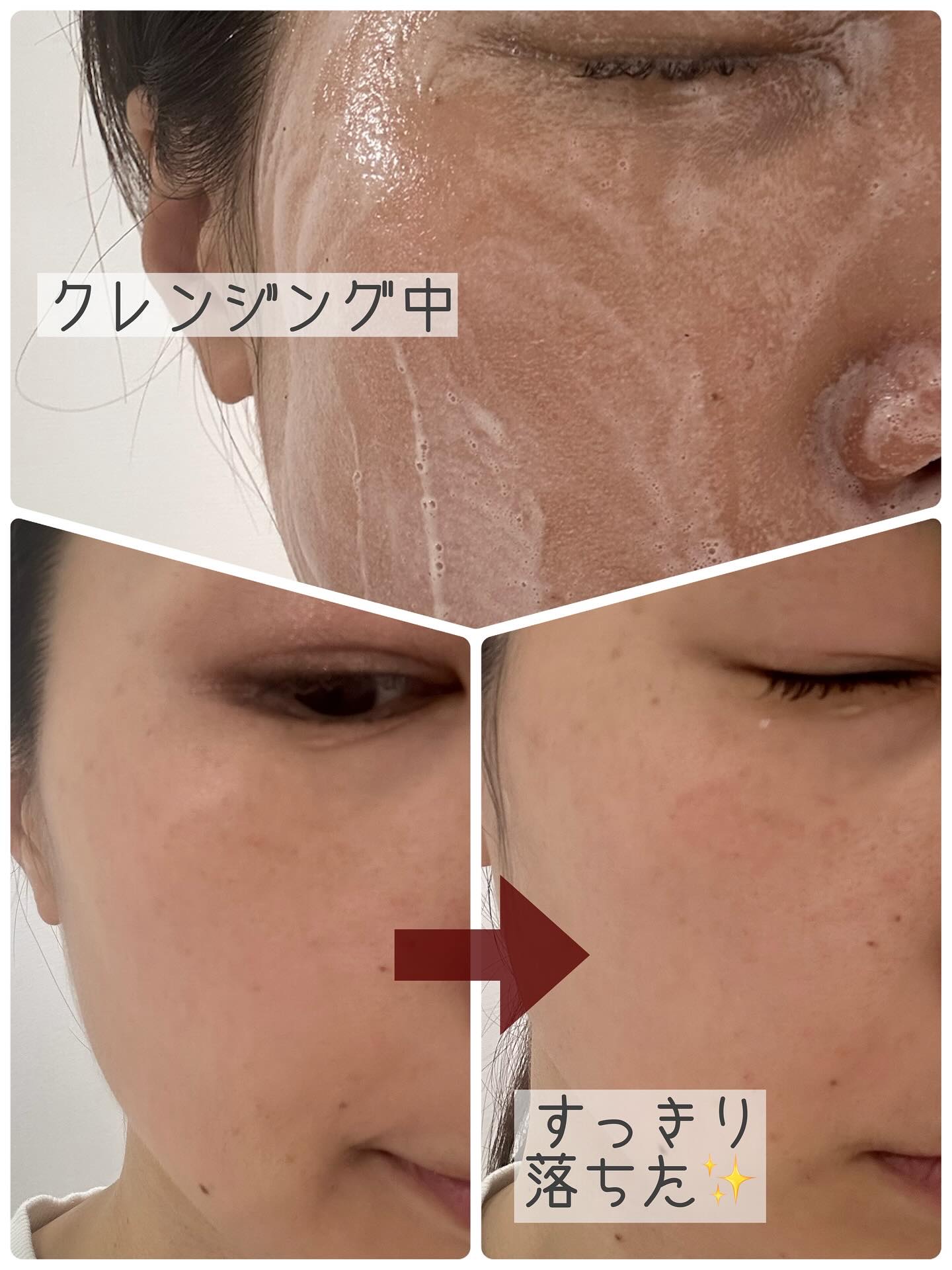 ポアオイルバブルクレンジング/CELORABY/その他洗顔料を使ったクチコミ（2枚目）