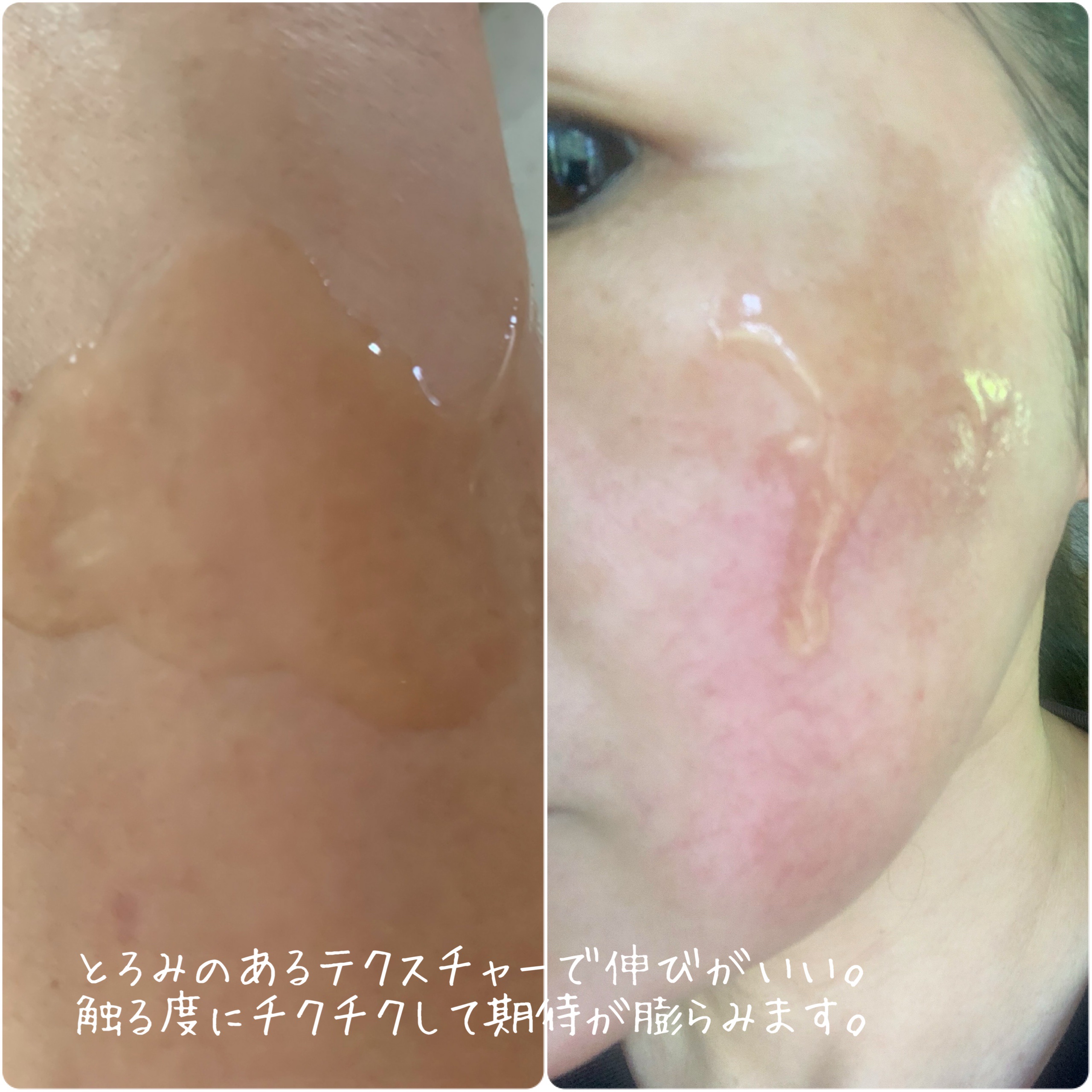 C×AZ ダーマインショット200/ESIENCE/美容液を使ったクチコミ（3枚目）