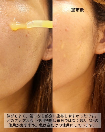 レチノール 0.2 ブースティングショット アンプル/SKIN1004/美容液を使ったクチコミ(7枚目)