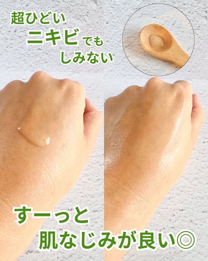 ノスカナイン トラブル セラム/FATION/美容液を使ったクチコミ(4枚目)