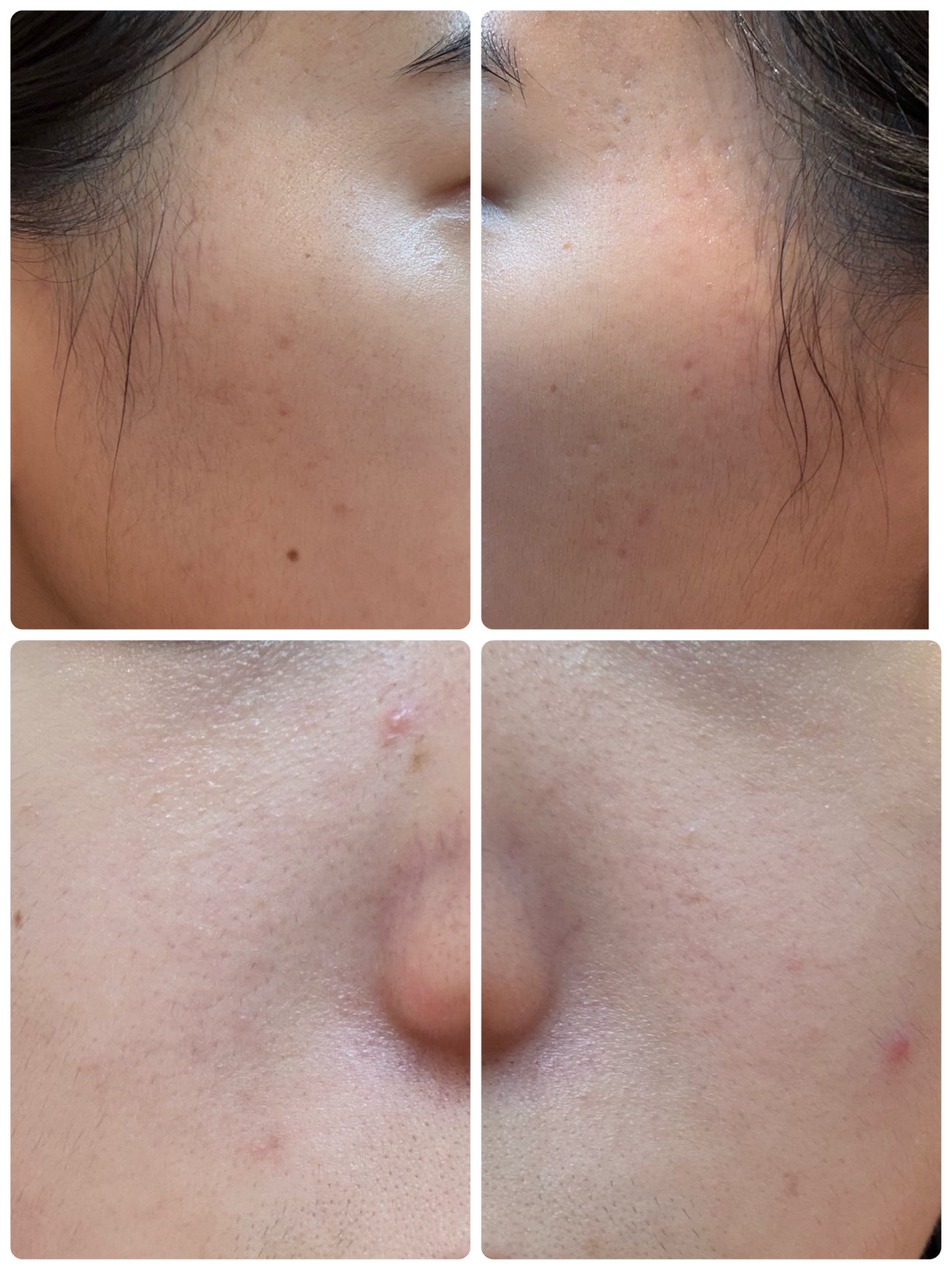 AGE-R ブースタープロ/MEDICUBE/美顔器・マッサージを使ったクチコミ(2枚目)