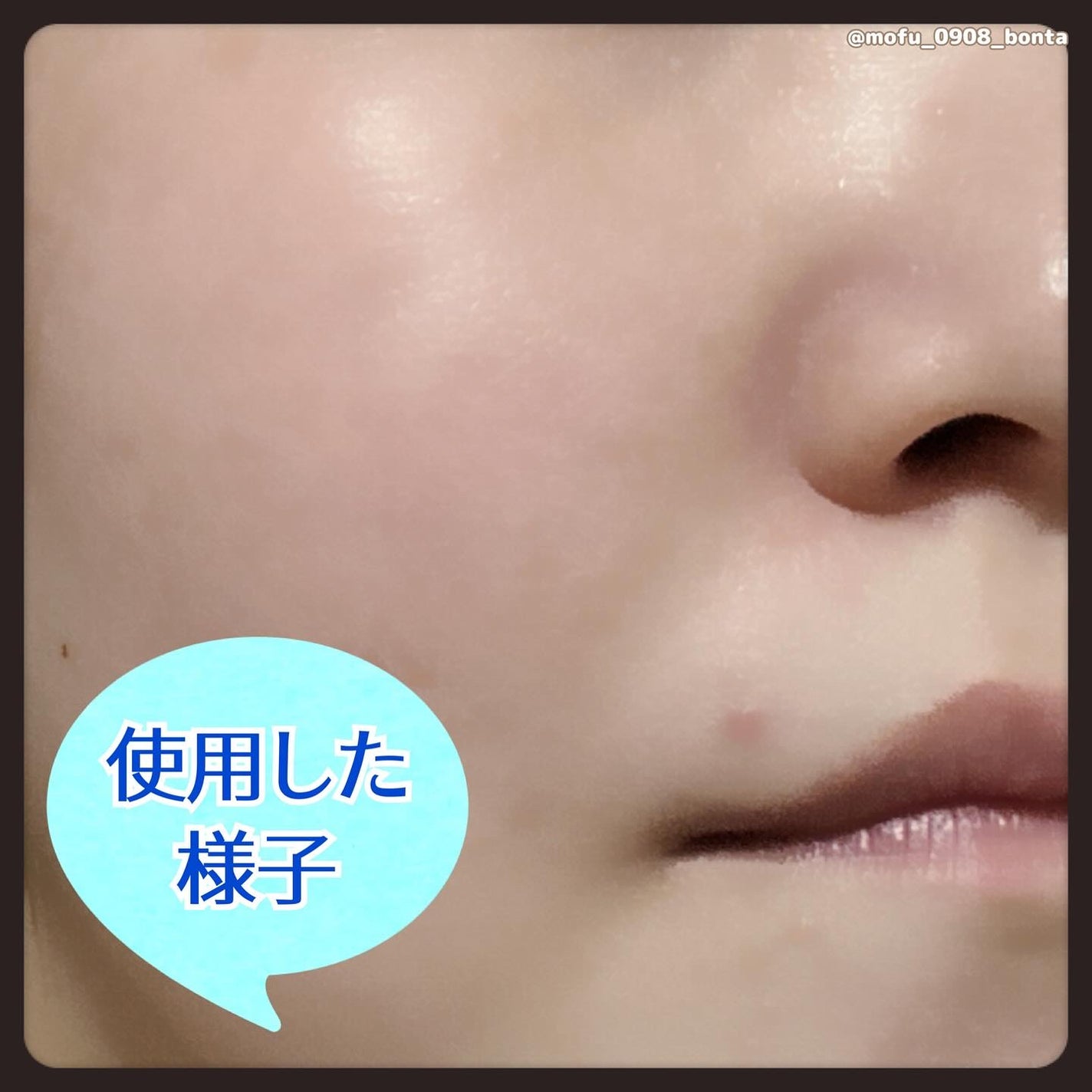 ジェニフィック アルティメ セラム/LANCOME/美容液を使ったクチコミ(5枚目)