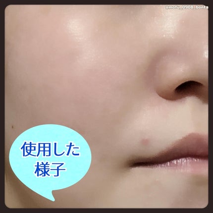 ジェニフィック アルティメ セラム/LANCOME/美容液を使ったクチコミ(5枚目)