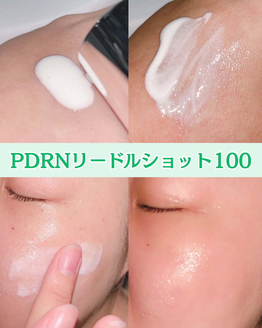 PDRN+リードルS 100/VT/美容液を使ったクチコミ（3枚目）