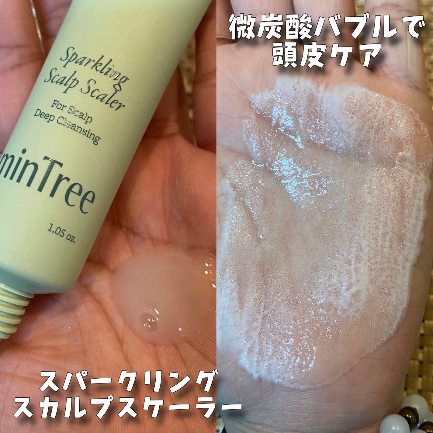 スパークリングスカルプスケーラー/ミンツリー/頭皮ケアを使ったクチコミ(5枚目)