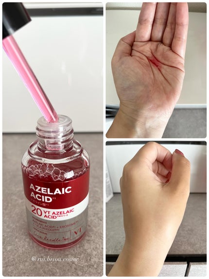 AZケア トナーパッド/VT/トナーパッドを使ったクチコミ(5枚目)