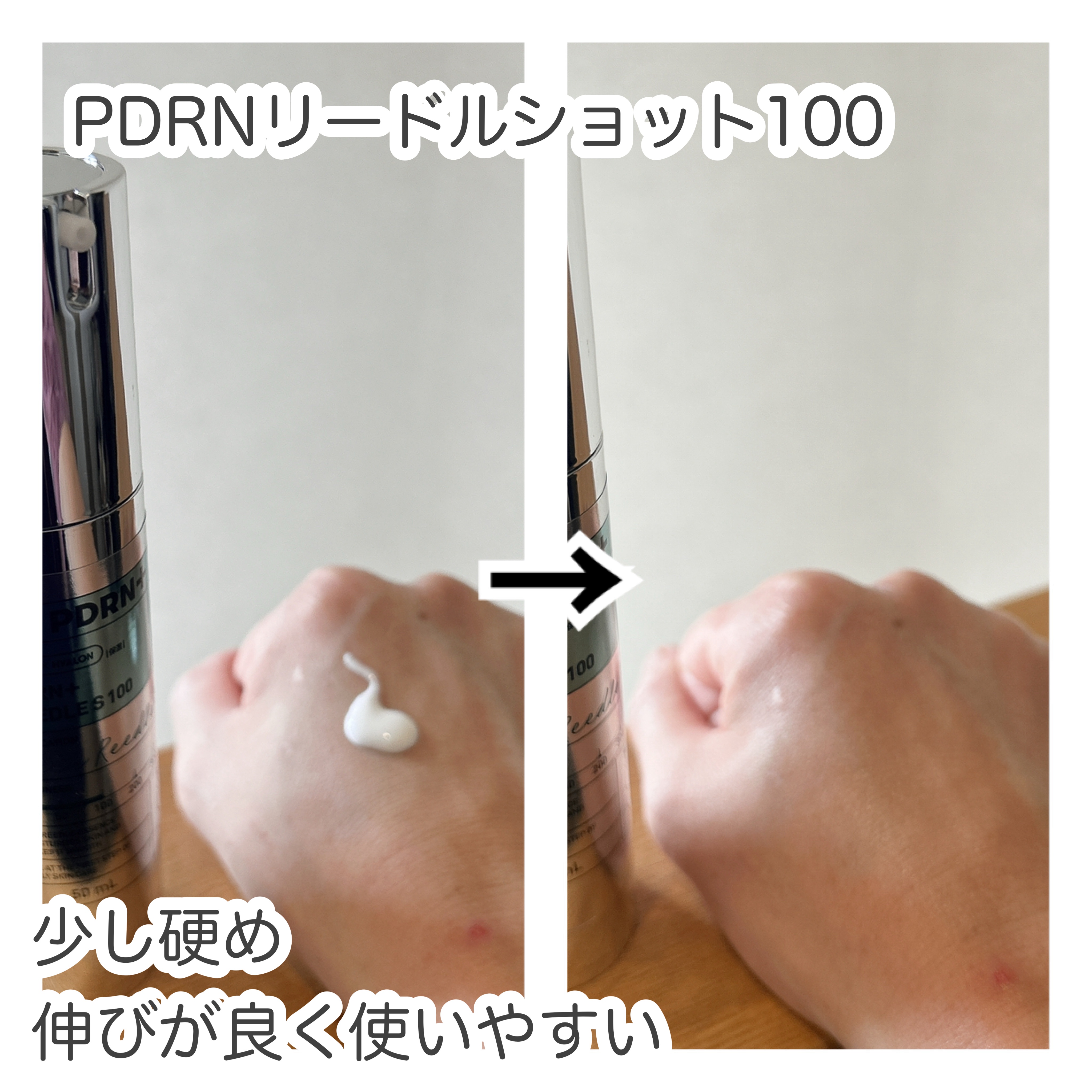 PDRN+リードルS 100/VT/美容液を使ったクチコミ（2枚目）