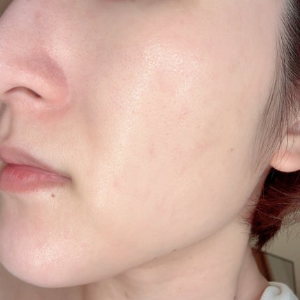 PDRN+リードルS 100/VT/美容液を使ったクチコミ(4枚目)