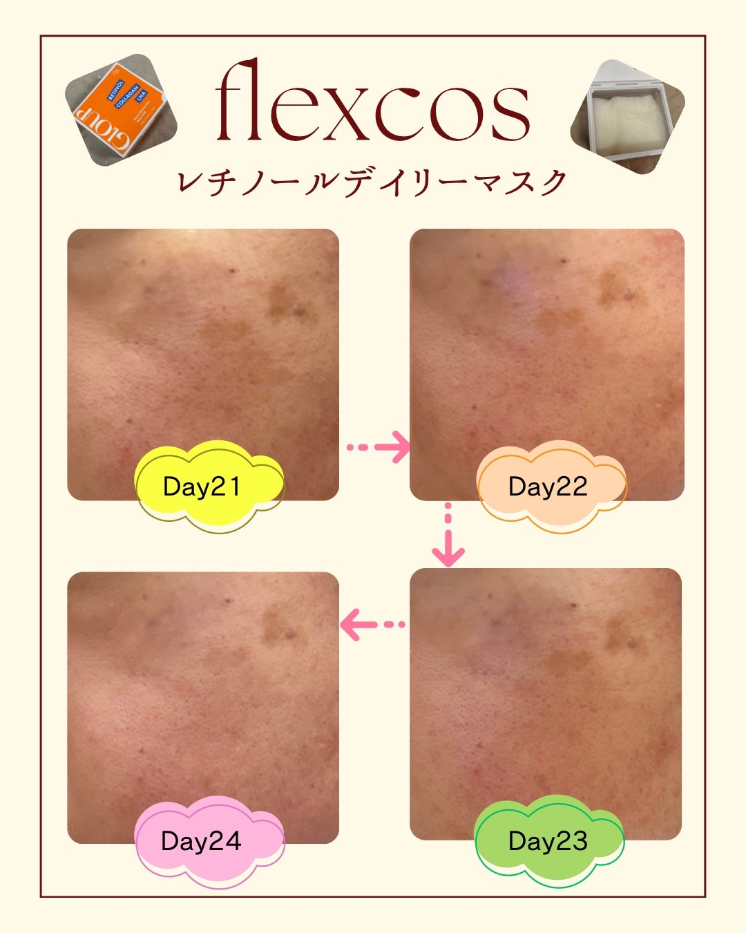 GLOUP DERMA RETINOL PLUS DAILY MASK/flexcos/シートマスク・パックを使ったクチコミ(10枚目)