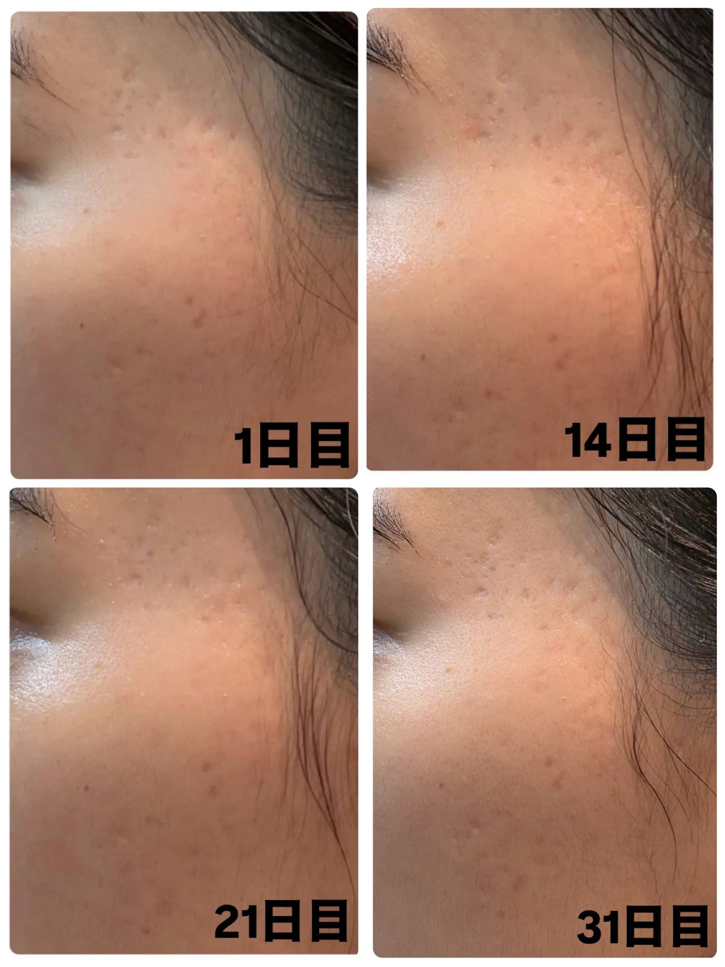 AGE-R ブースタープロ/MEDICUBE/美顔器・マッサージを使ったクチコミ(3枚目)