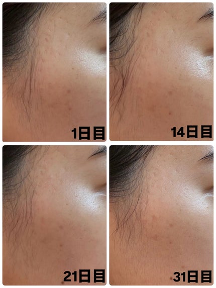 AGE-R ブースタープロ ホワイト(ミニ)/MEDICUBE/美顔器・マッサージの画像