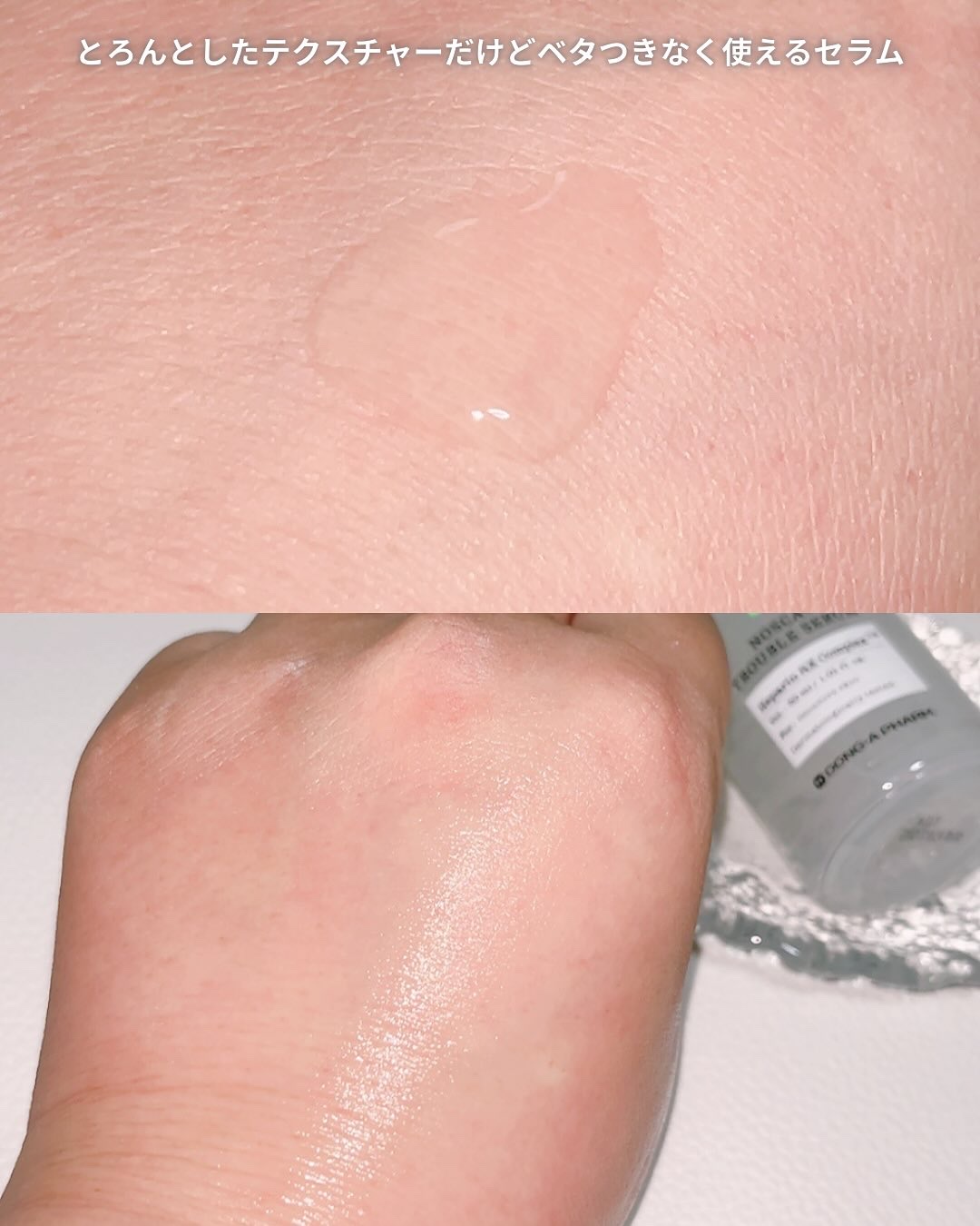 ノスカナイン トラブル セラム/FATION/美容液を使ったクチコミ（3枚目）