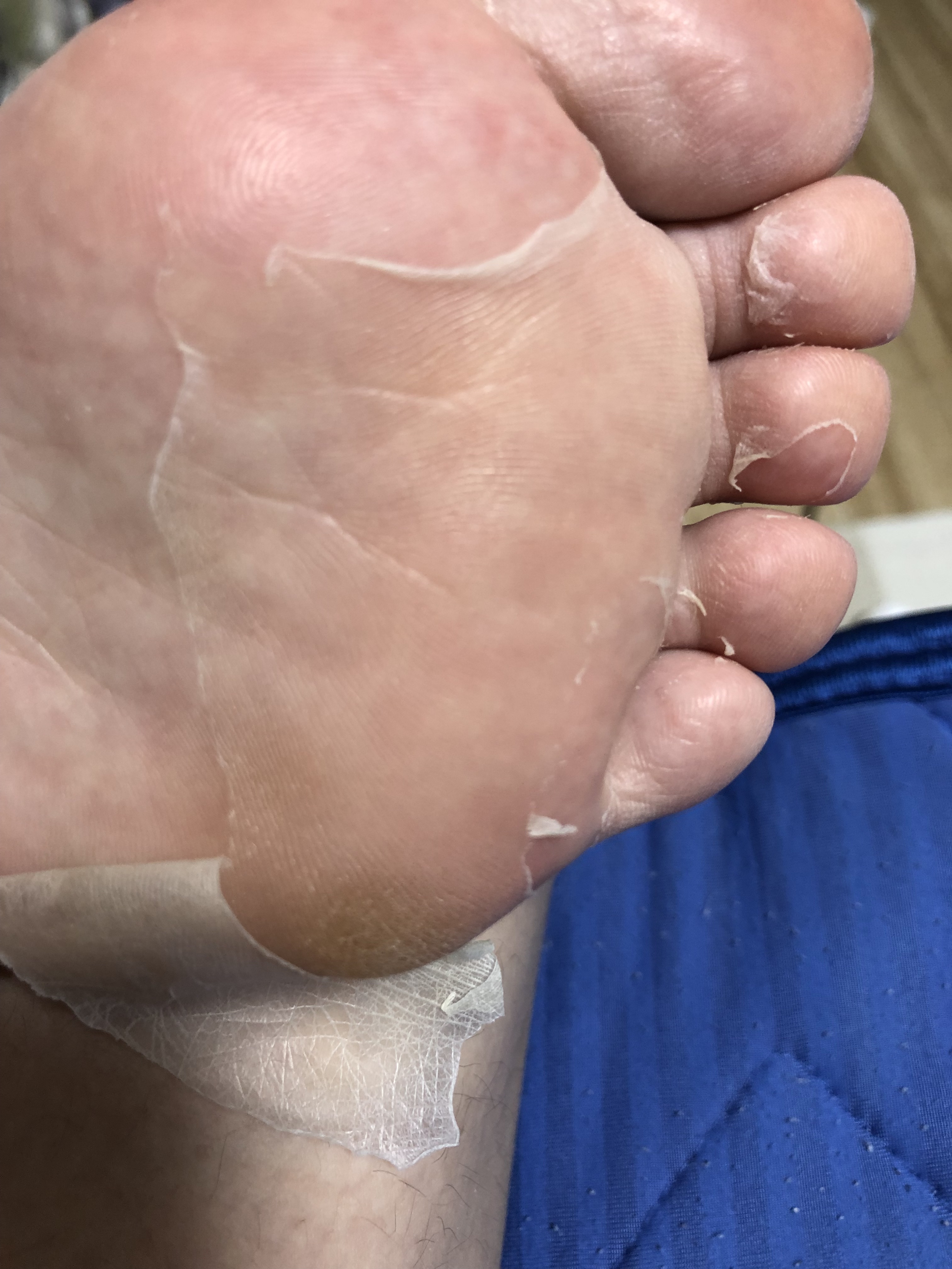 ふわふわマシュマロフット/リベルタ/レッグ・フットケアを使ったクチコミ（3枚目）