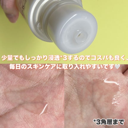 VC ホワイトピールゲル/SKIO/美容液を使ったクチコミ(5枚目)