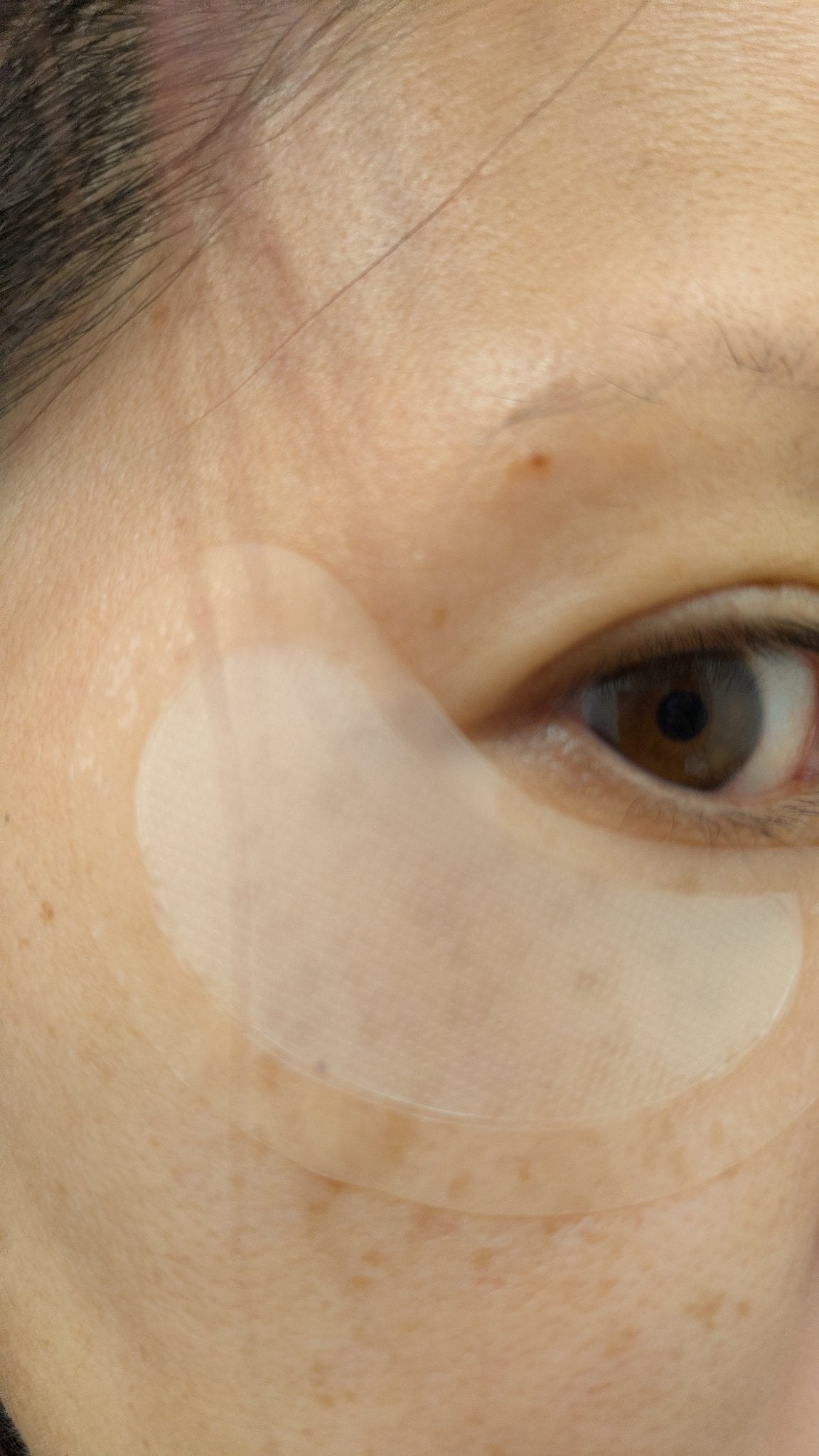 アイバックリフト1100シャットリードルパッチ/CHARDE/シートマスク・パックを使ったクチコミ(3枚目)