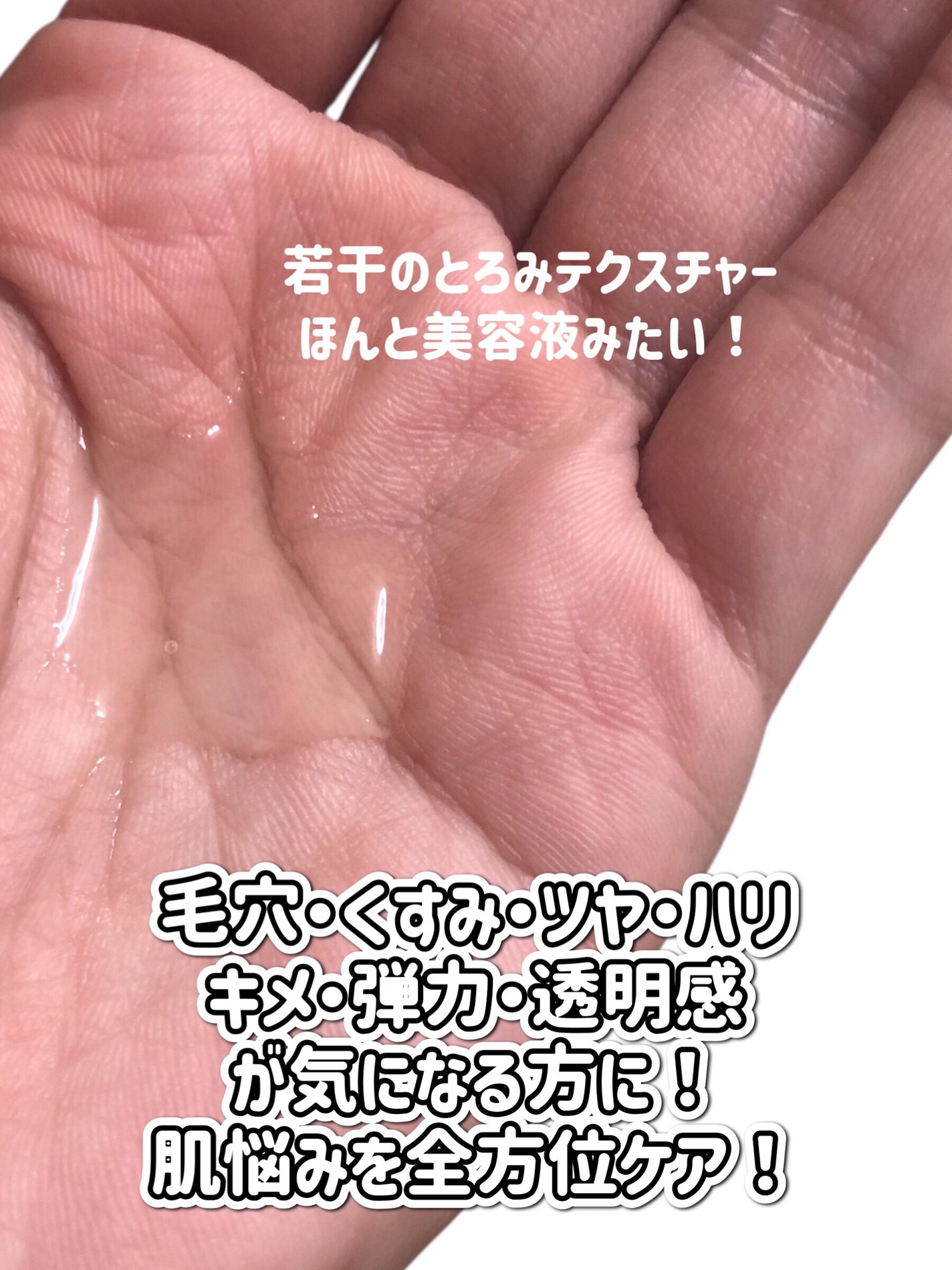 ダーマレーザー スーパーVC100ローション(さっぱり)/クオリティファースト/化粧水を使ったクチコミ(4枚目)