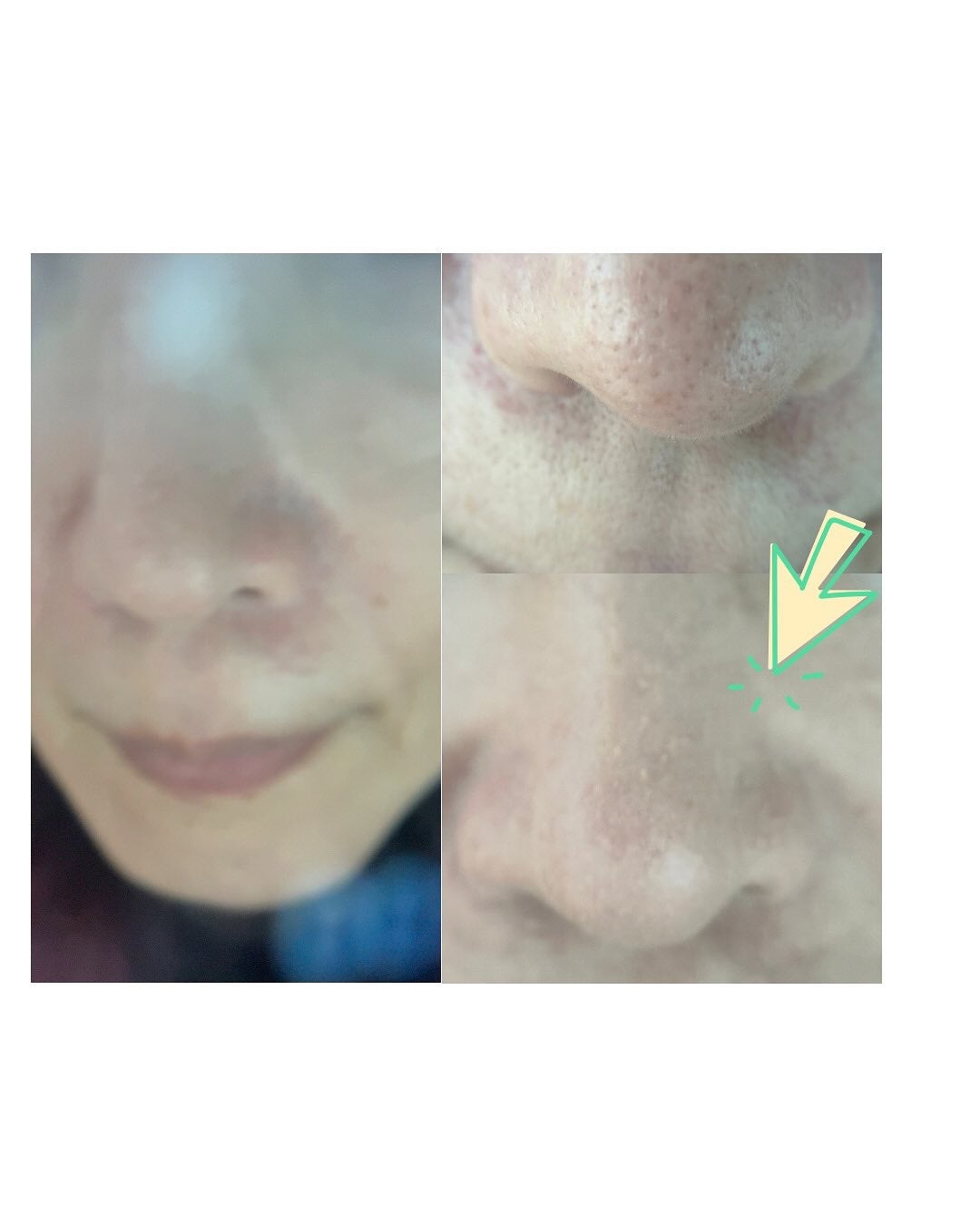 ヘルシーカバープライマー/AN’BLESS/化粧下地を使ったクチコミ(5枚目)