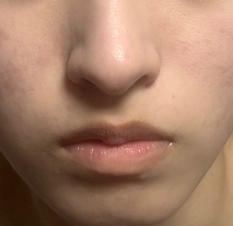 エバユースBBプラスC(医薬品)/第一三共ヘルスケア/その他を使ったクチコミ（3枚目）