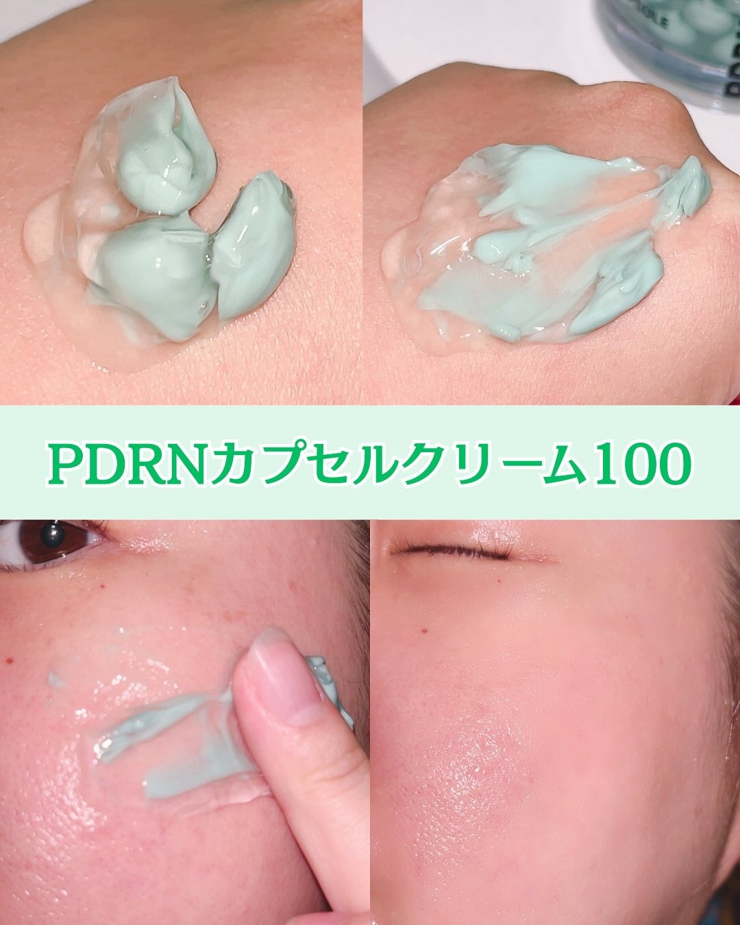 PDRN+リードルS 100/VT/美容液を使ったクチコミ(5枚目)