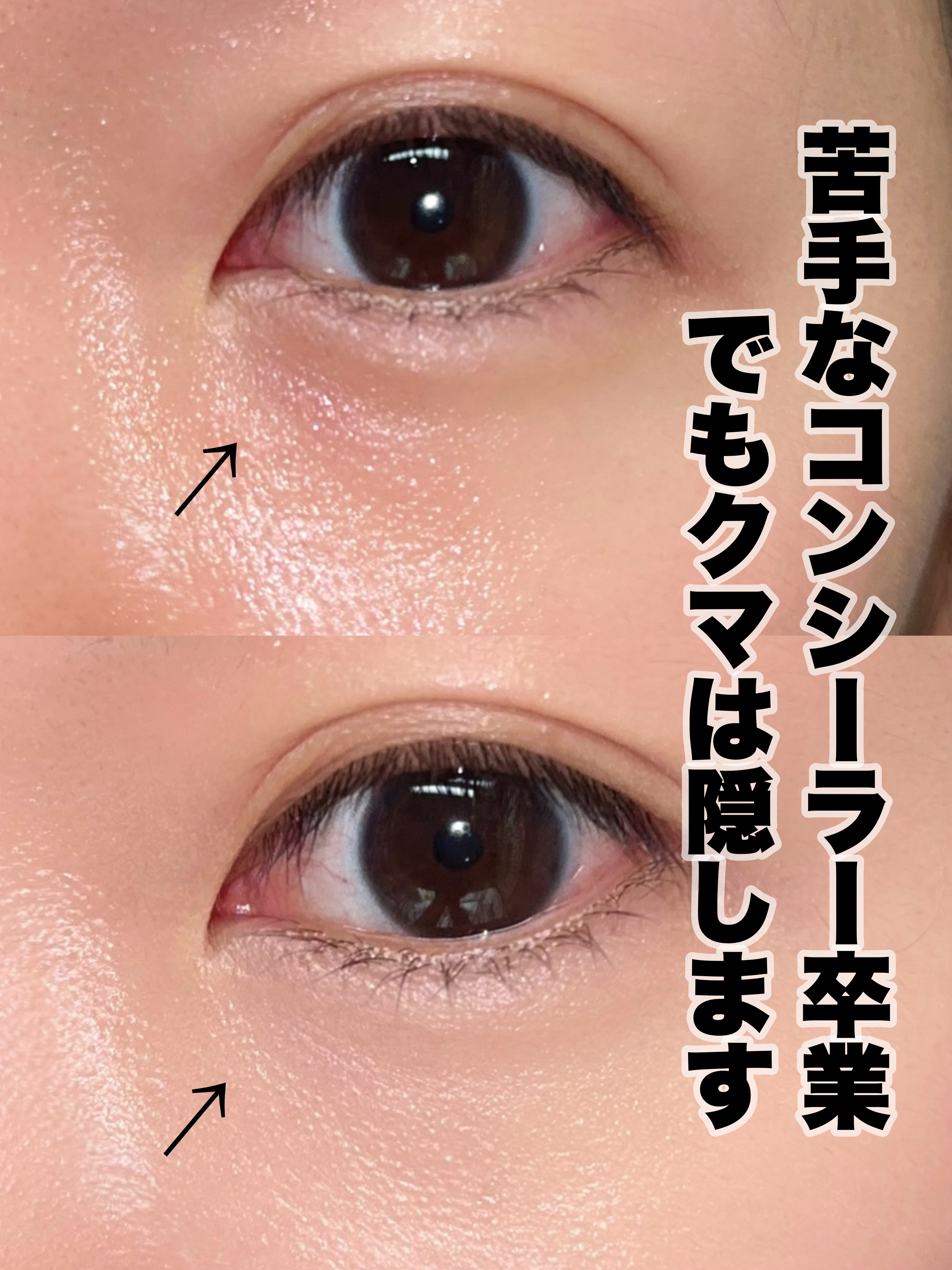 アイレノール クマクリーム アイレノール クマクリームS/IRENOL/アイケア・アイクリームを使ったクチコミ（1枚目）