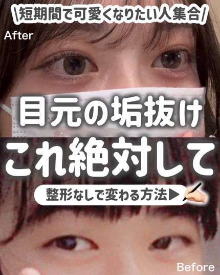 ナチュラルアイロールオンN/カントリー&ストリーム/アイケア・アイクリームを使ったクチコミ(1枚目)