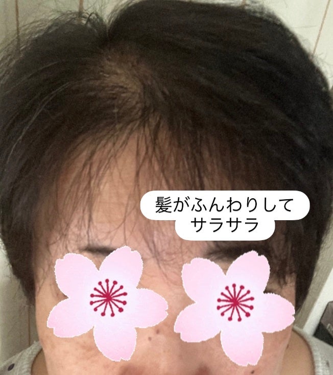 スカルプシャンプー/ トリートメント タイプ DS/DEMI DO/サロンシャンプーを使ったクチコミ(6枚目)