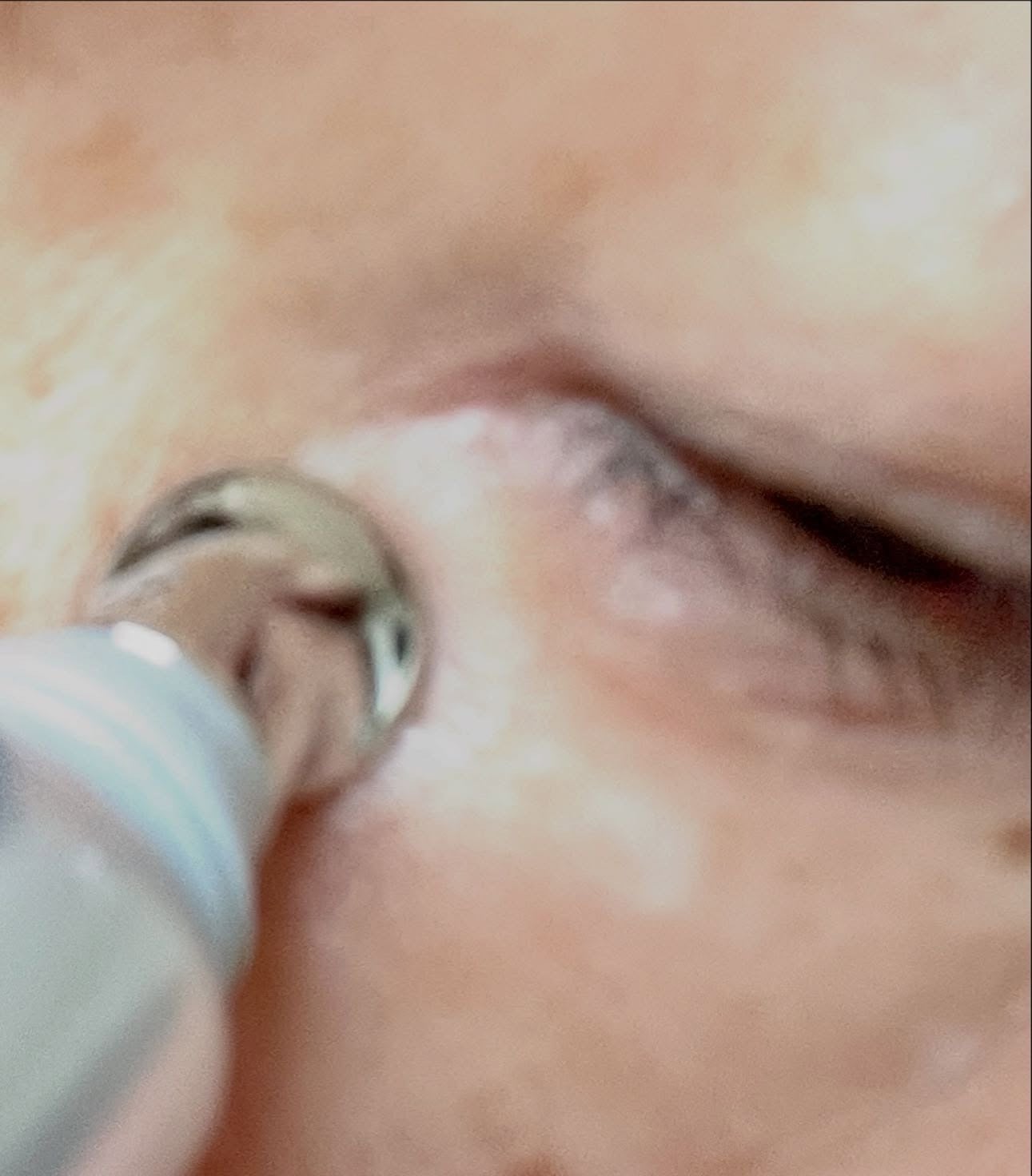 センシティブ リンクルトーンセラム/Asmy/美容液を使ったクチコミ(3枚目)