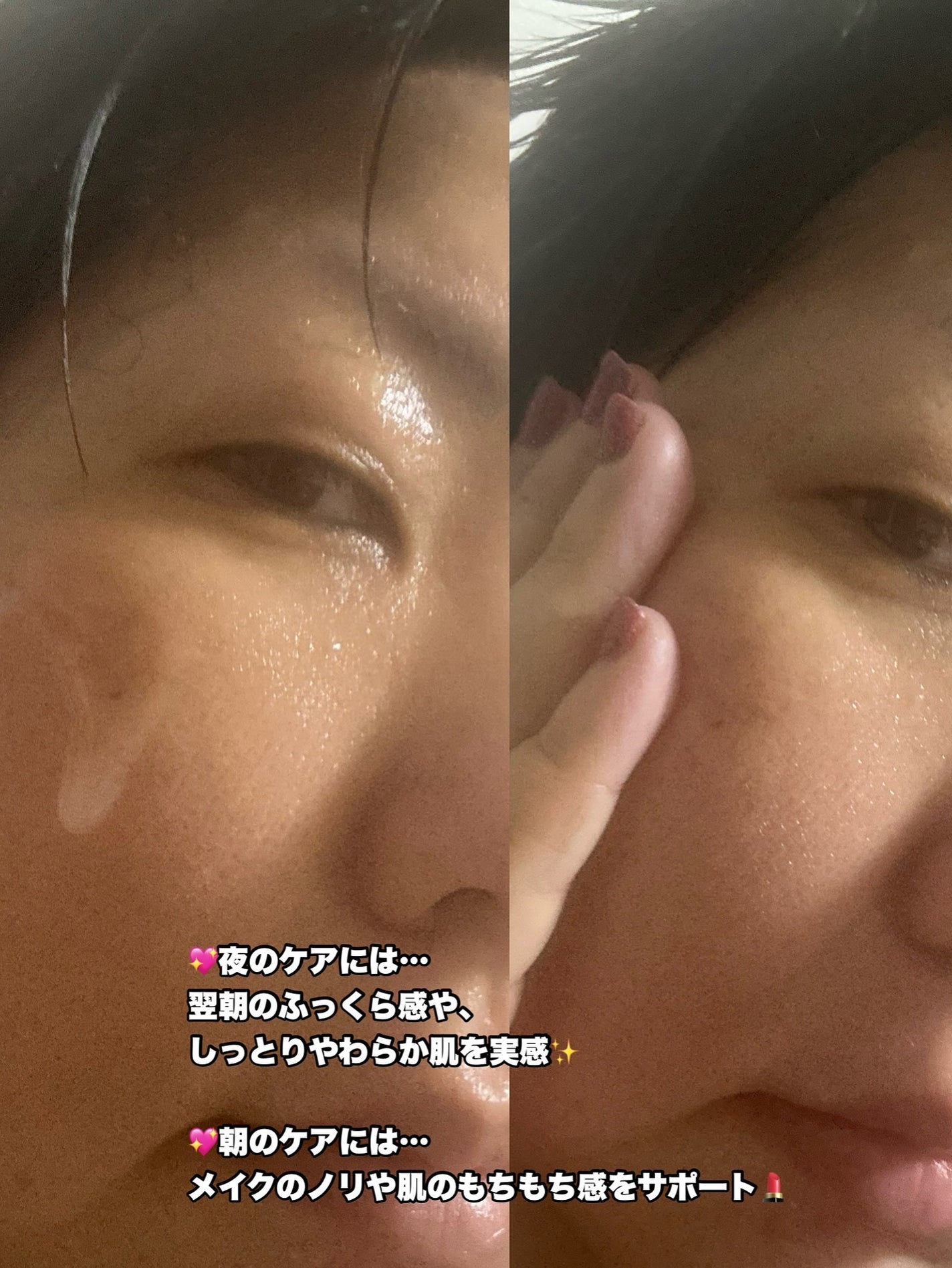 プレミアムビューティーセラム PDRN+美容液/CICIBELLA/美容液を使ったクチコミ(3枚目)