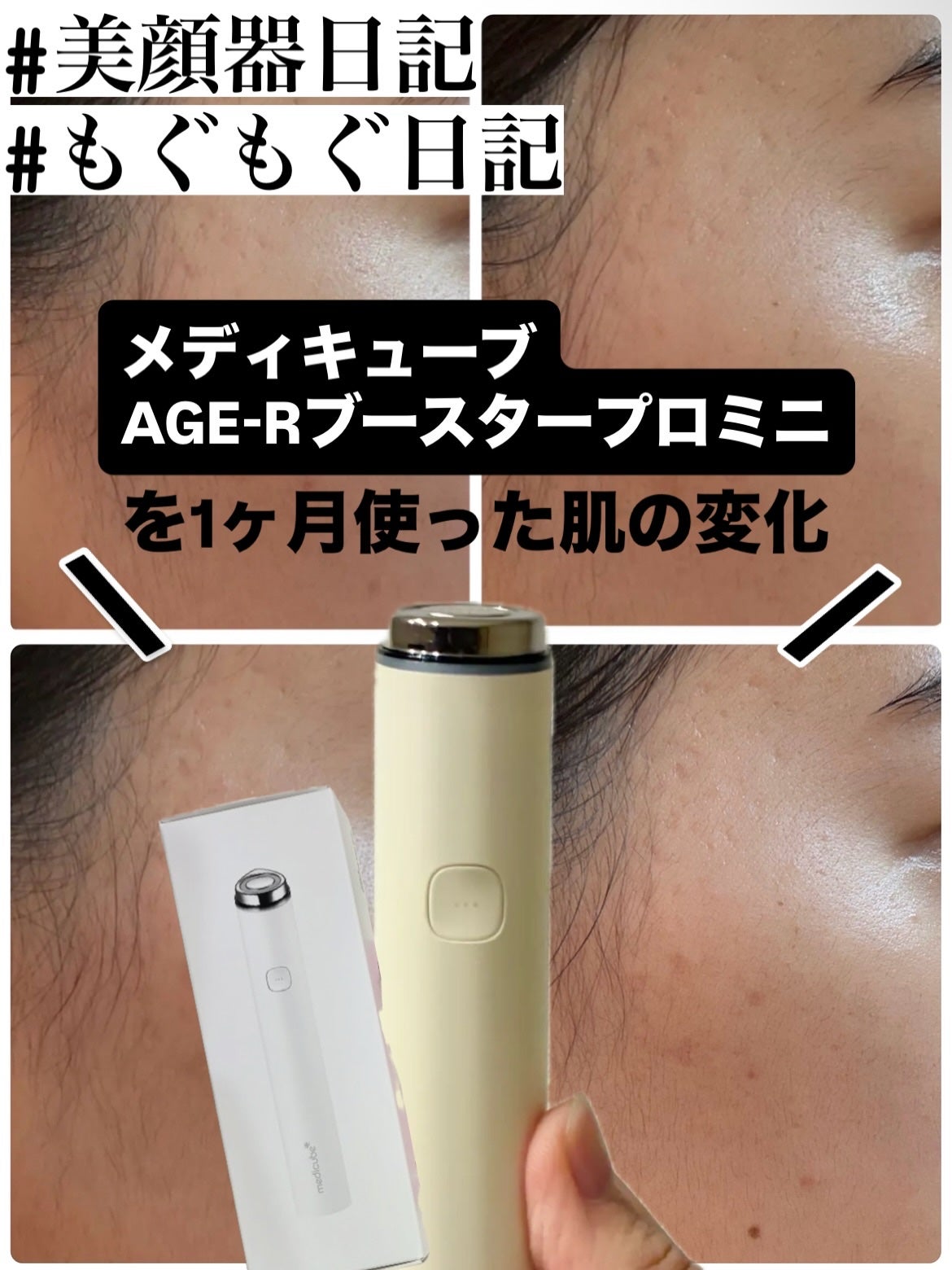 AGE-R ブースタープロ/MEDICUBE/美顔器・マッサージを使ったクチコミ(1枚目)