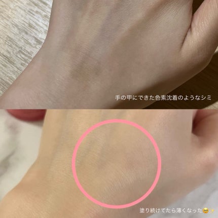 リデンス チェリートーン&スポットコレクターアンプル/redence/美容液を使ったクチコミ(1枚目)