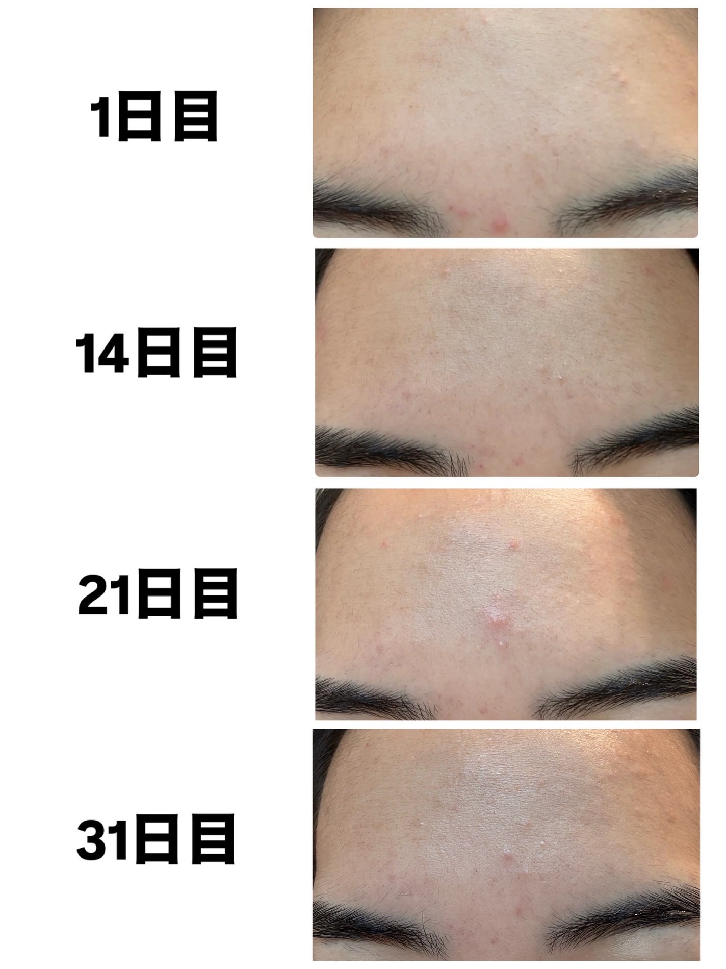 AGE-R ブースタープロ/MEDICUBE/美顔器・マッサージを使ったクチコミ(5枚目)