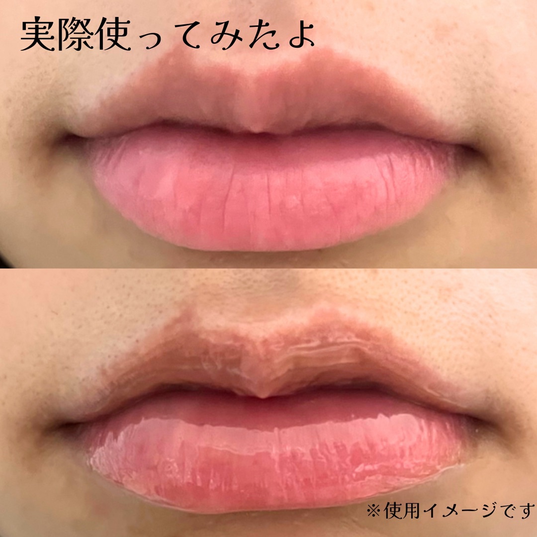 MWAH NEEDLE LIPS/MWAH/リッププランパーを使ったクチコミ（3枚目）