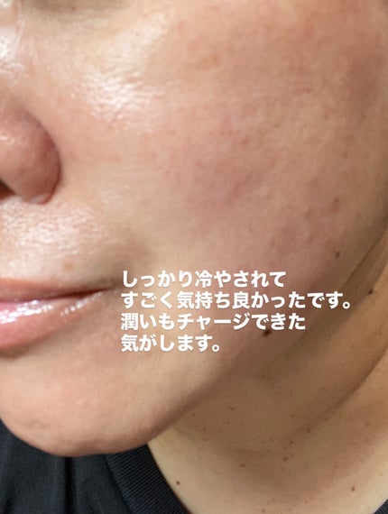 HydroB5 スキンマグネットマスク/Dr.nineteen/シートマスク・パックを使ったクチコミ(8枚目)