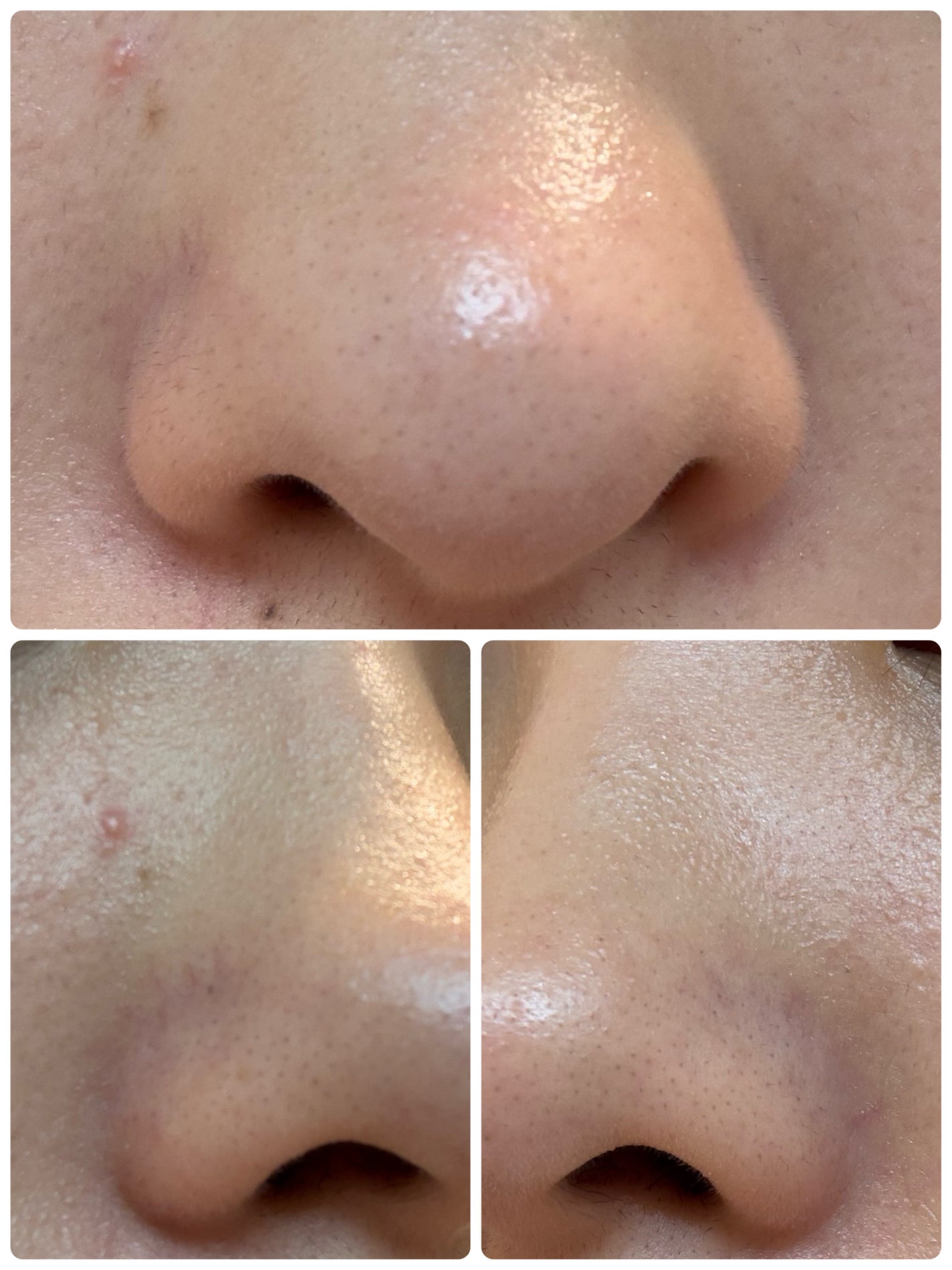 モーニングジェルウォッシュ/ビトレスキン/その他洗顔料を使ったクチコミ(4枚目)