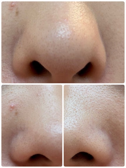 AGE-R ブースタープロ/MEDICUBE/美顔器・マッサージを使ったクチコミ(4枚目)