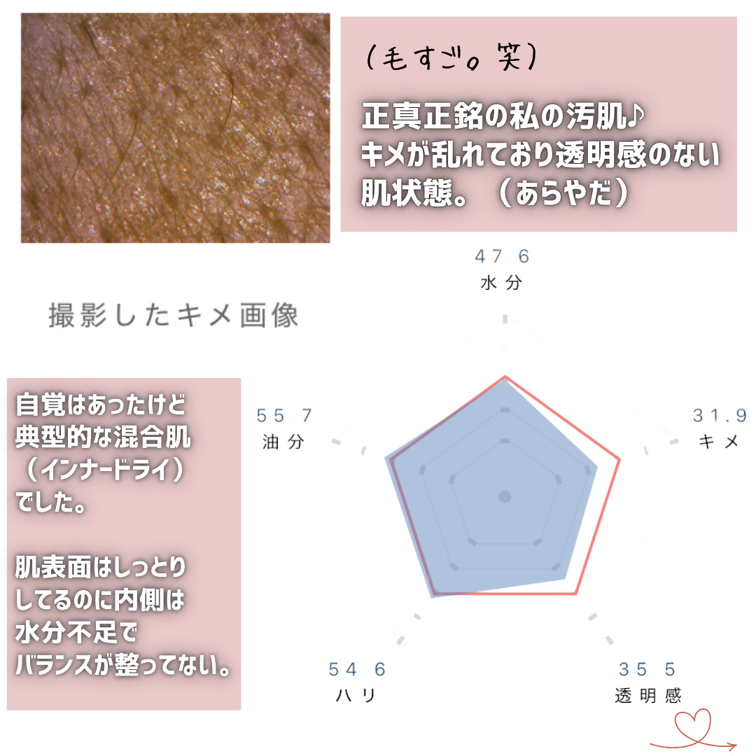 オルビスユー エッセンスローション /オルビス/化粧水を使ったクチコミ（3枚目）