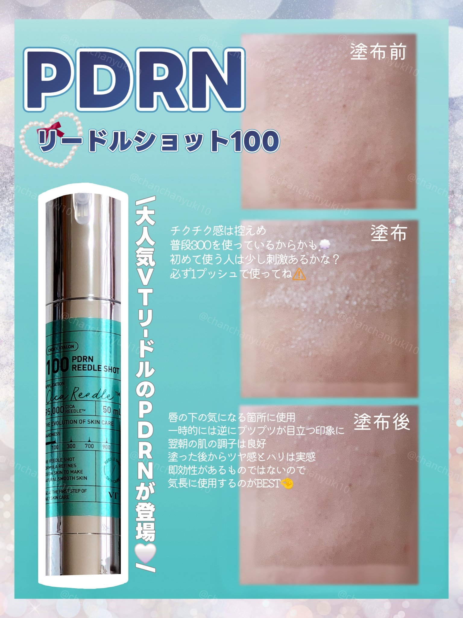 PDRN+リードルS 100/VT/美容液を使ったクチコミ（2枚目）