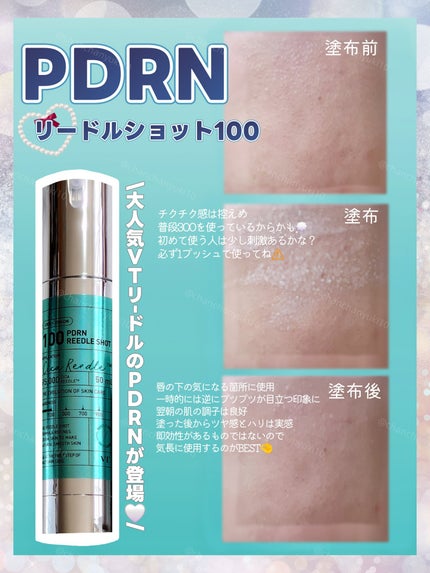 PDRN+リードルS 100/VT/美容液を使ったクチコミ(2枚目)